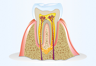 Zahnarztpraxis Dr. Dietl: Endodontie